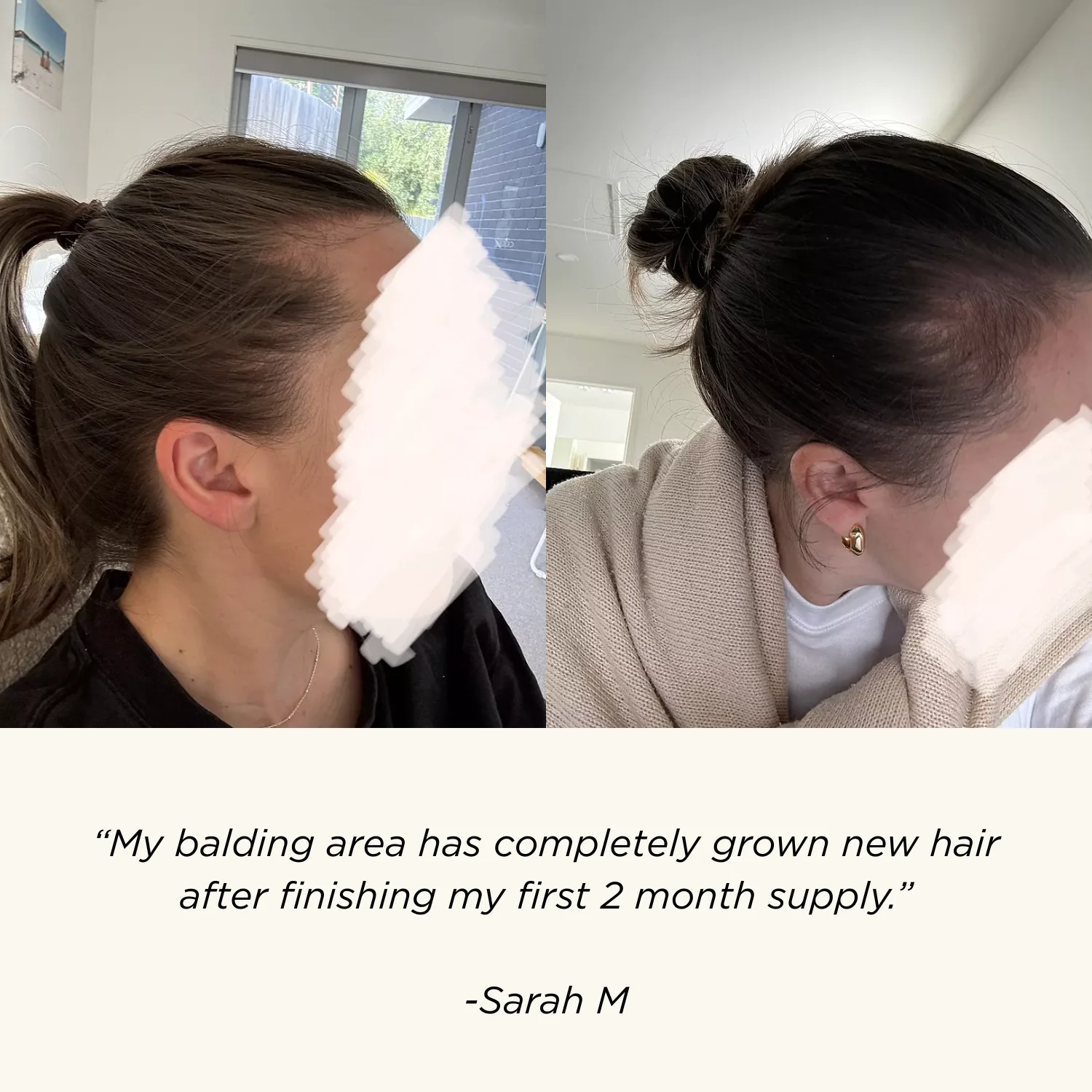 Vita-Growth Peptide Scalp Serum - Image 4